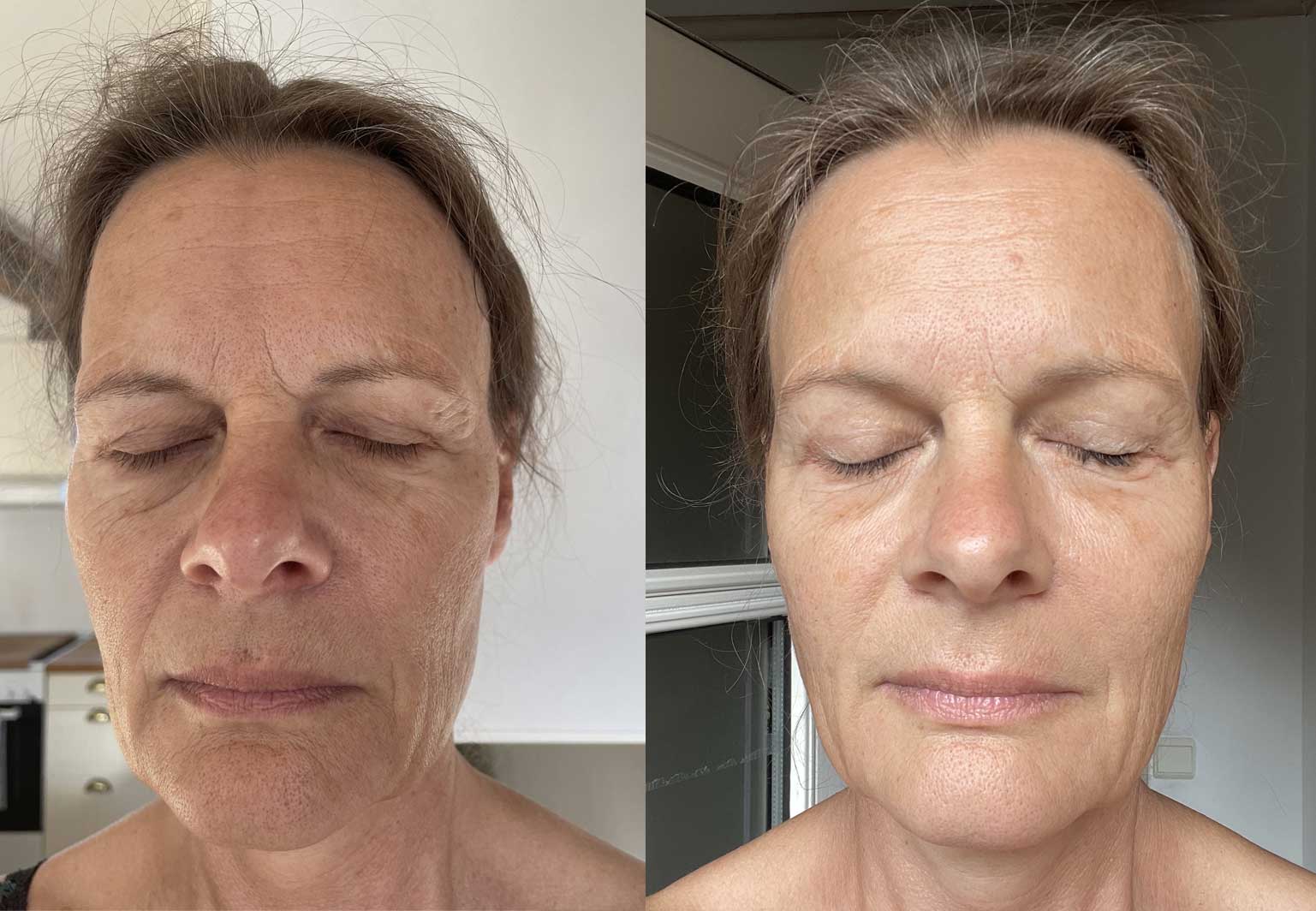 Malene Julie (before and after, 6 weeks)